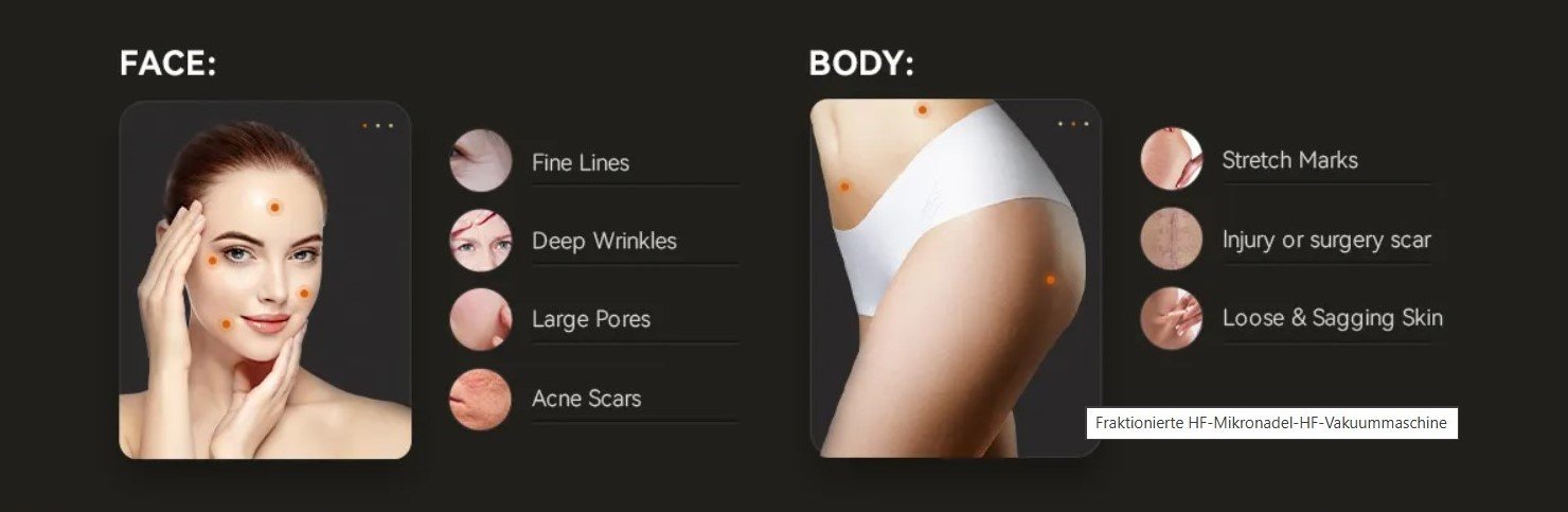 RF Microneedle Fractional Machine mit Vakuum 10 Mikronadel-RF-Applikator – präzise Hautverjüngung ohne Ablation